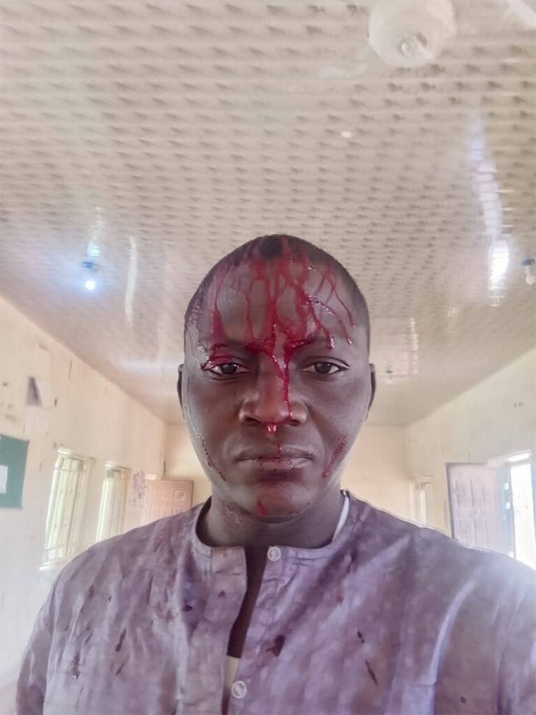 NUJ condemns Police brutality against Bauchi journalist,  insists command must bear full responsibility to settle all medical expenses incurred by victim