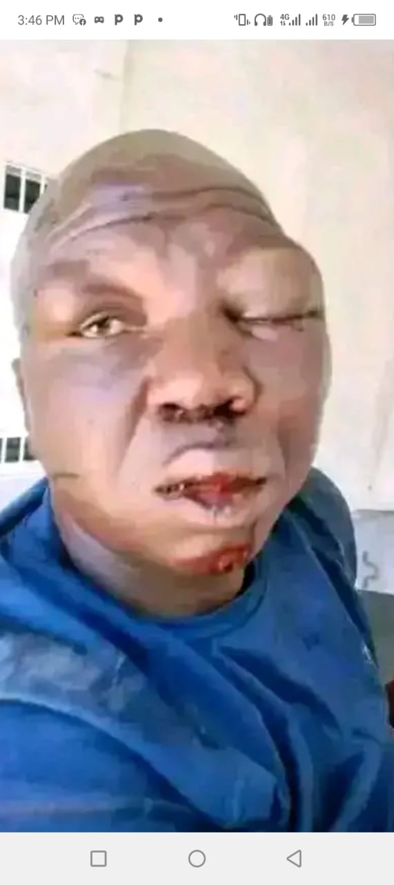 Unicef ,Jigawa assure to vaccinate 1.5 children against Polio virus   By Umar Akilu Majeri Dutse