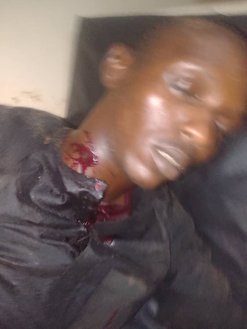 A GROUP OF SUSPECTED HOODLUMS ATTACKED GUJUNGU MARKET INJURED VARIOUS PEOPLE LEFT OTHERS STRANDED